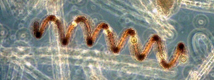 Anabaena Mikroskopaufnahme